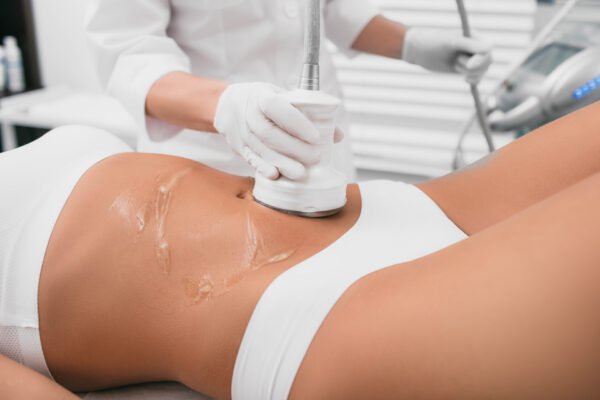 RF & Cavitation - Image 3