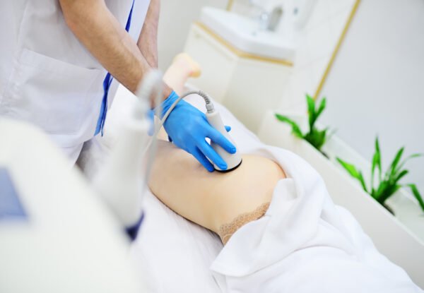 RF & Cavitation - Image 2