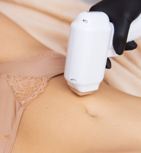 Diode & Brightening Laser - Image 4