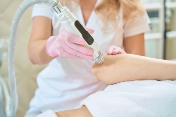 RF Microneedling & Exosomes - Image 5